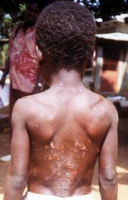 10-Tausende-Kindersklaven-w